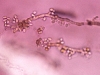 o_Aureobasidium hongos suelo
